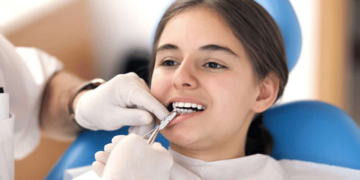 Teeth Straightening for Teens: What Parents Should Know